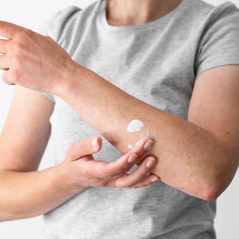 Stop aux moustiques